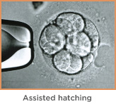 Assisted Embryo Hatching